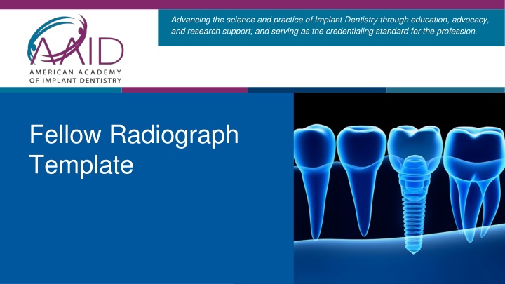 advancing the science and practice of implant