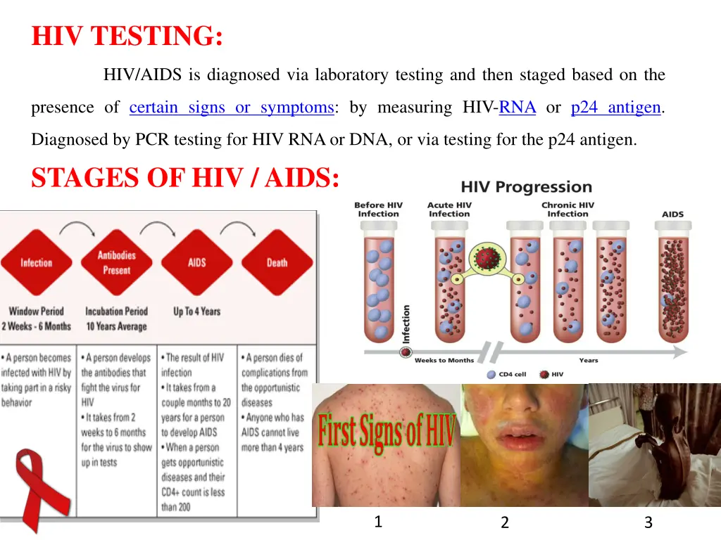 hiv testing