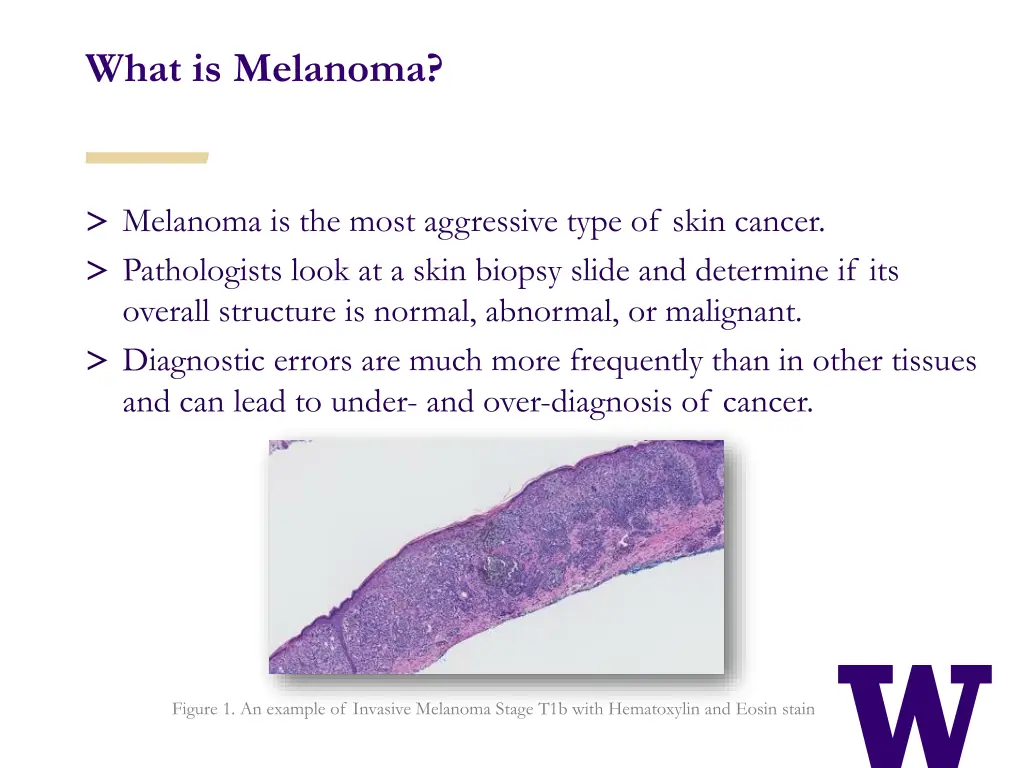 what is melanoma 1