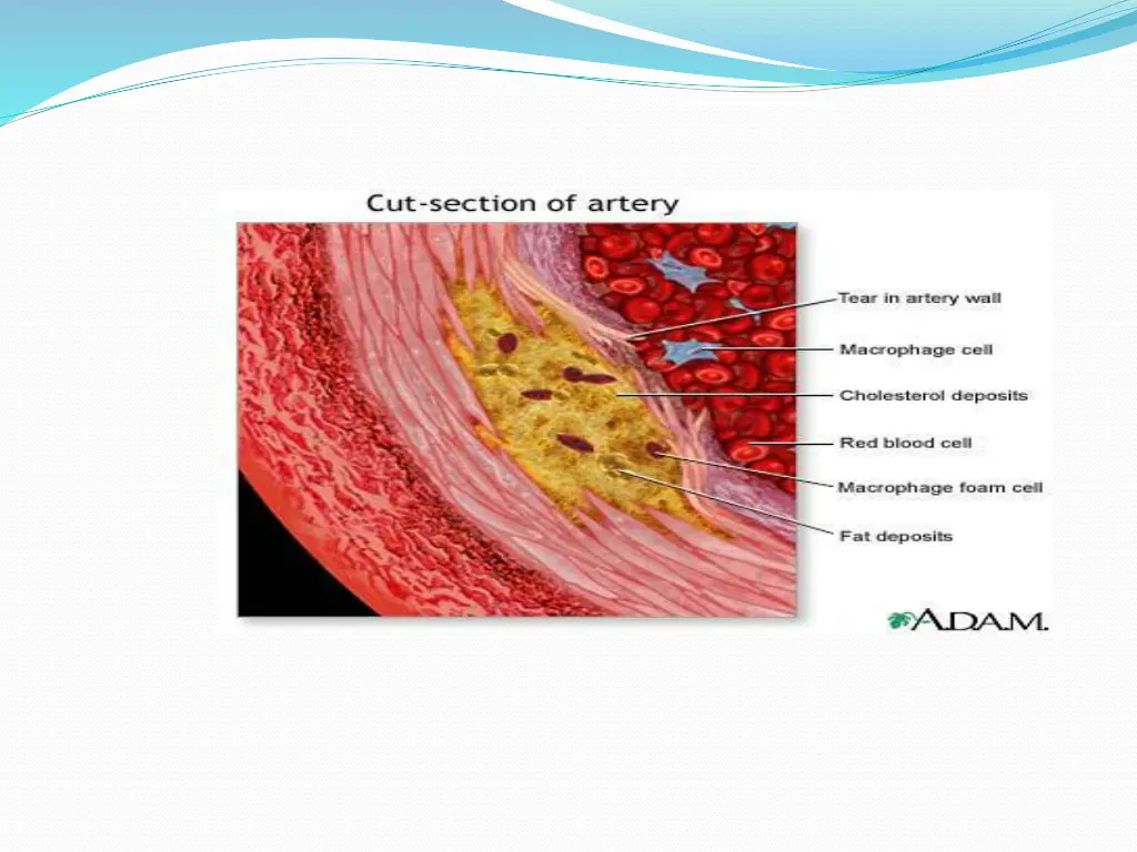 slide21