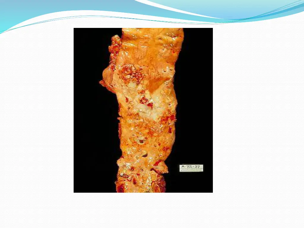 slide22