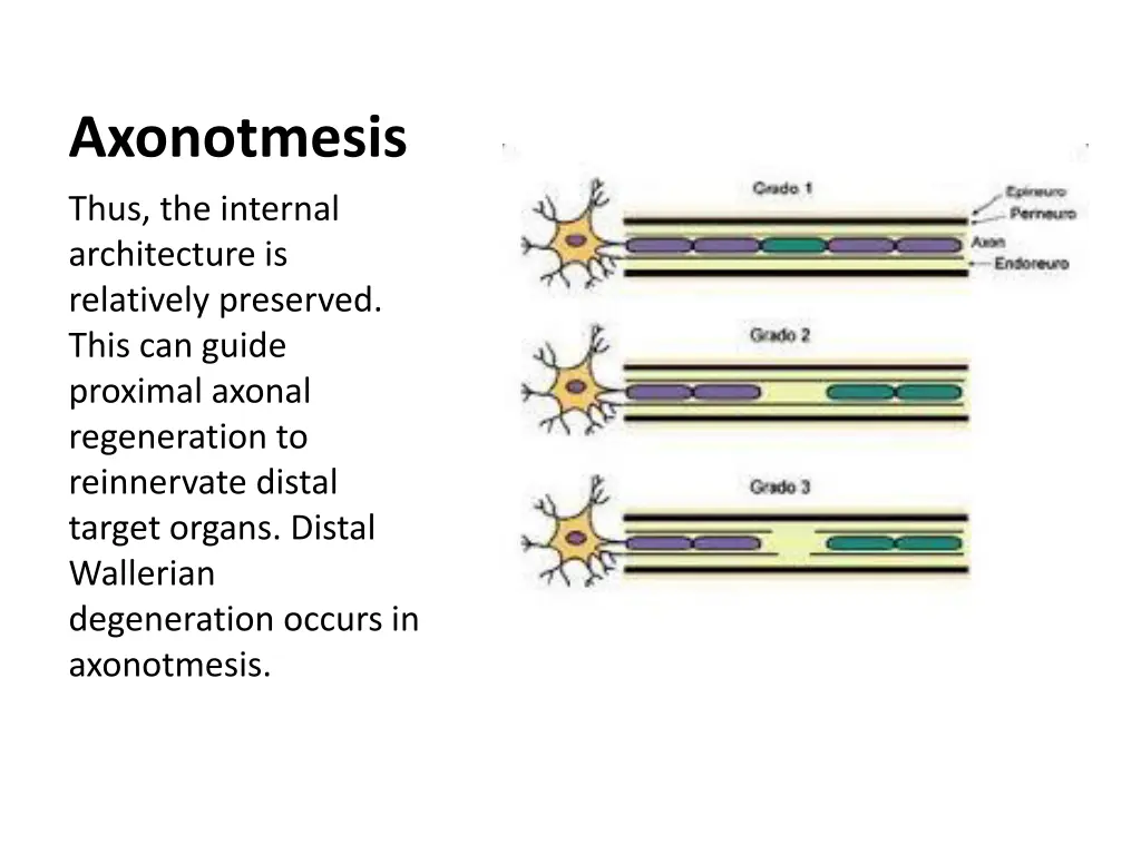 axonotmesis 1