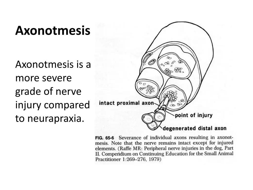axonotmesis