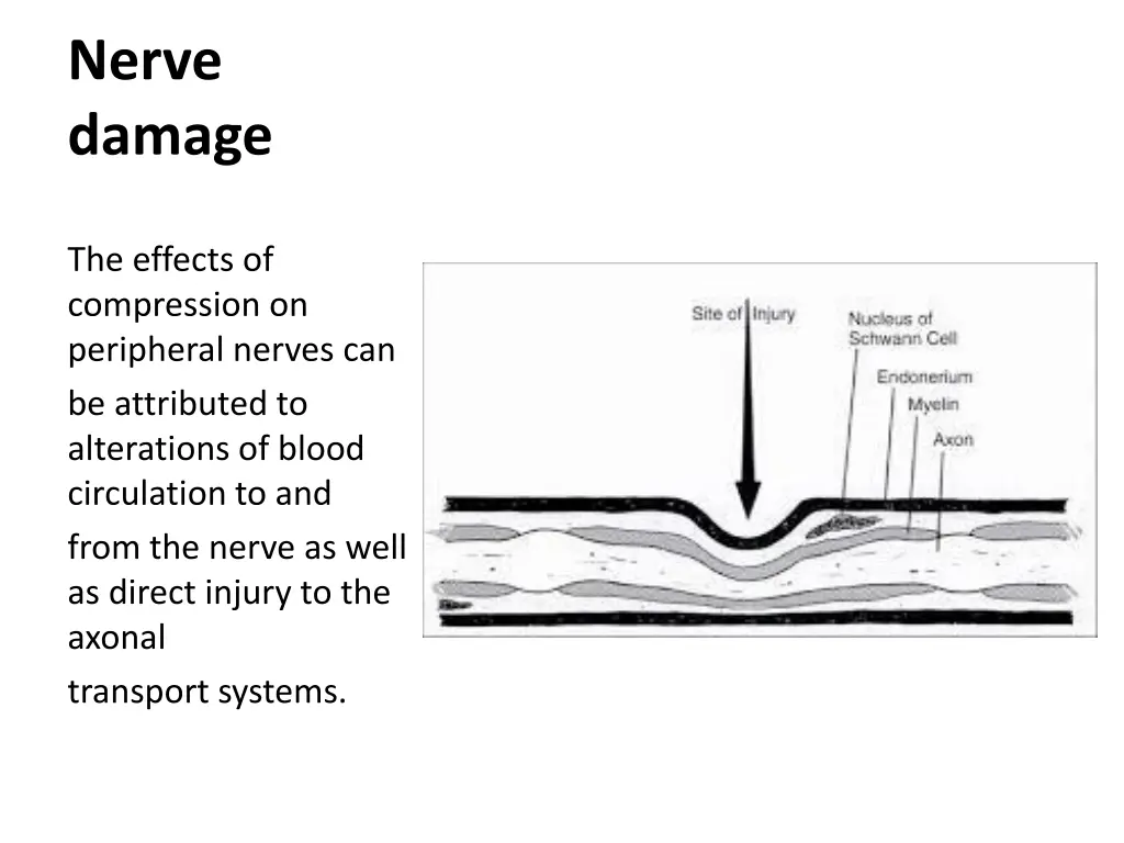 nerve damage 1