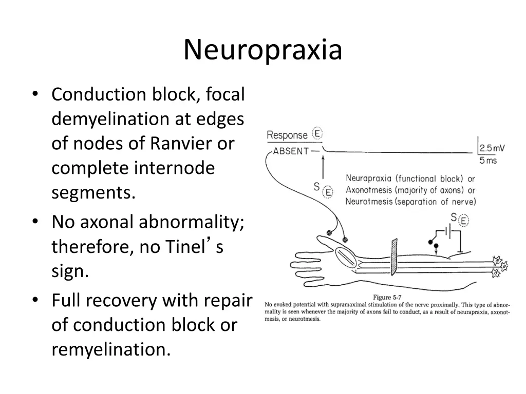neuropraxia 1