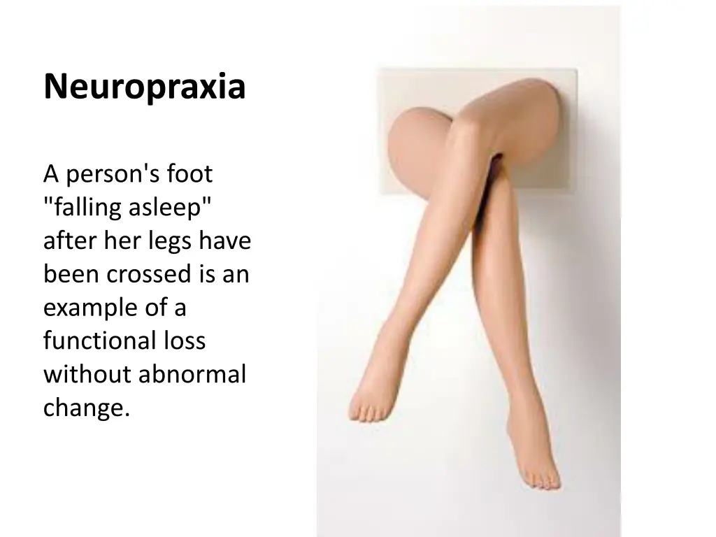 neuropraxia 2