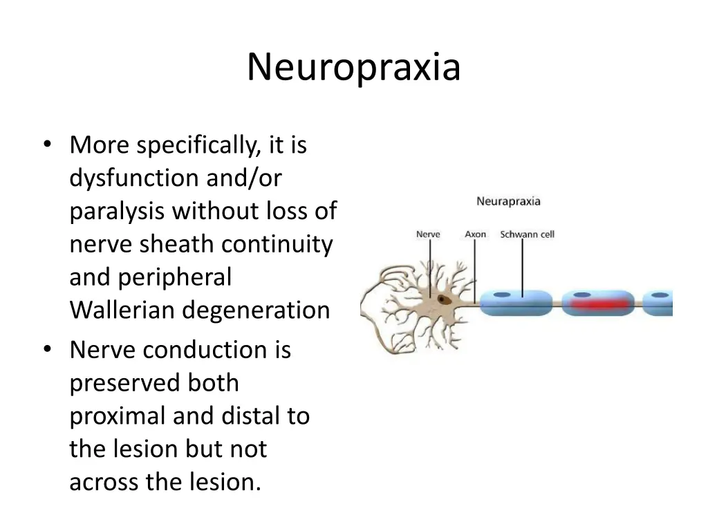 neuropraxia
