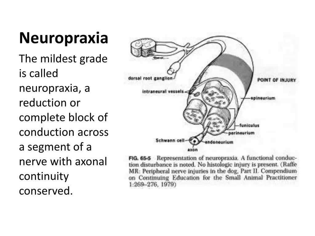 neuropraxia the mildest grade is called