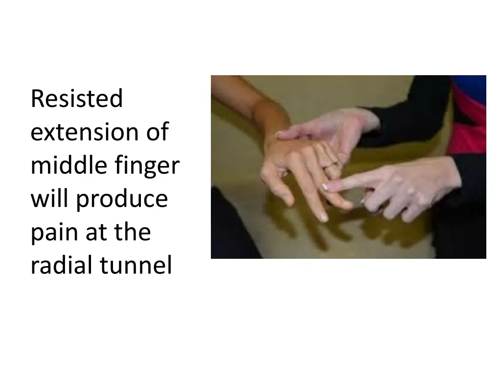resisted extension of middle finger will produce