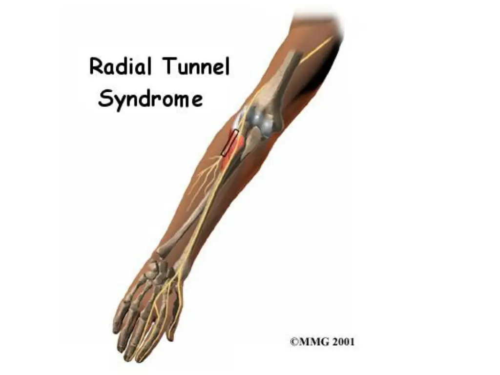 slide12