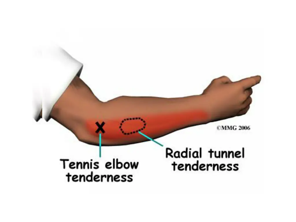 slide32
