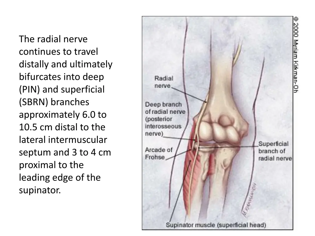 the radial nerve continues to travel distally