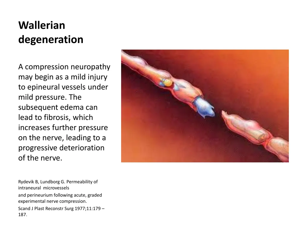 wallerian degeneration