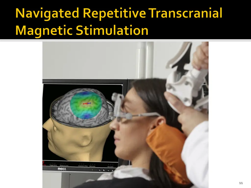 slide11