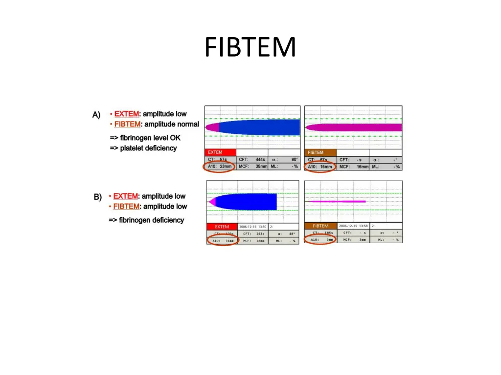 fibtem