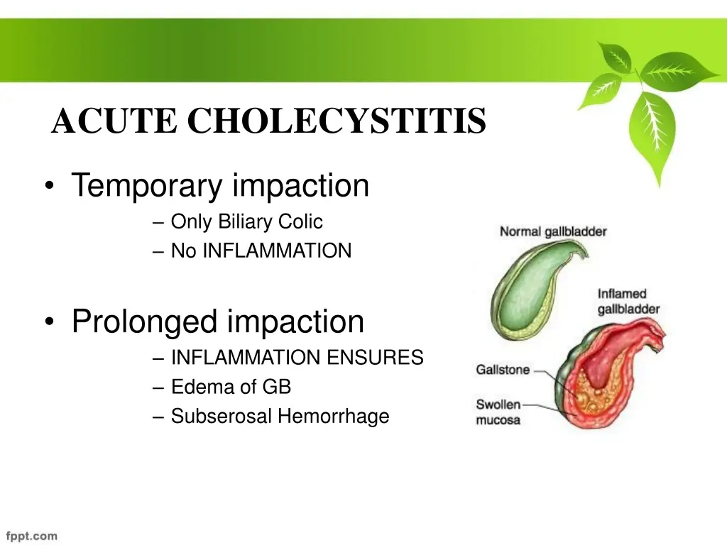 acute cholecystitis 1
