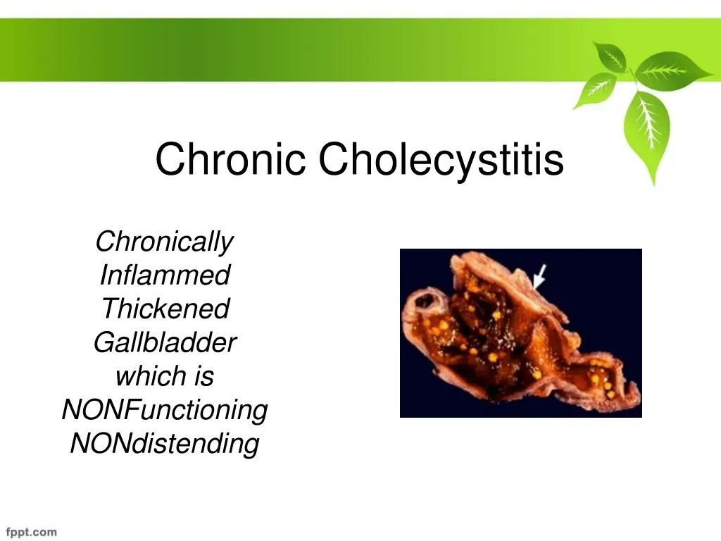 chronic cholecystitis