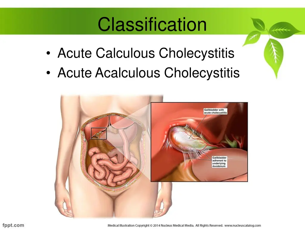 classification