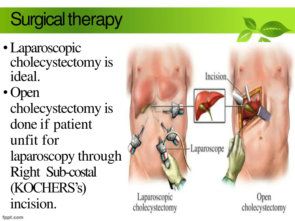 surgicaltherapy