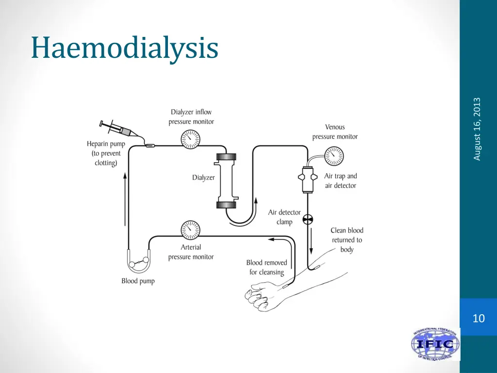 haemodialysis