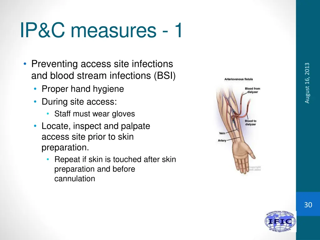 ip c measures 1