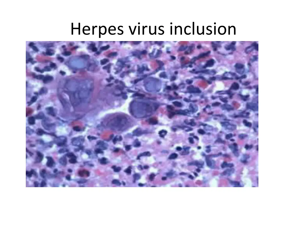 herpes virus inclusion