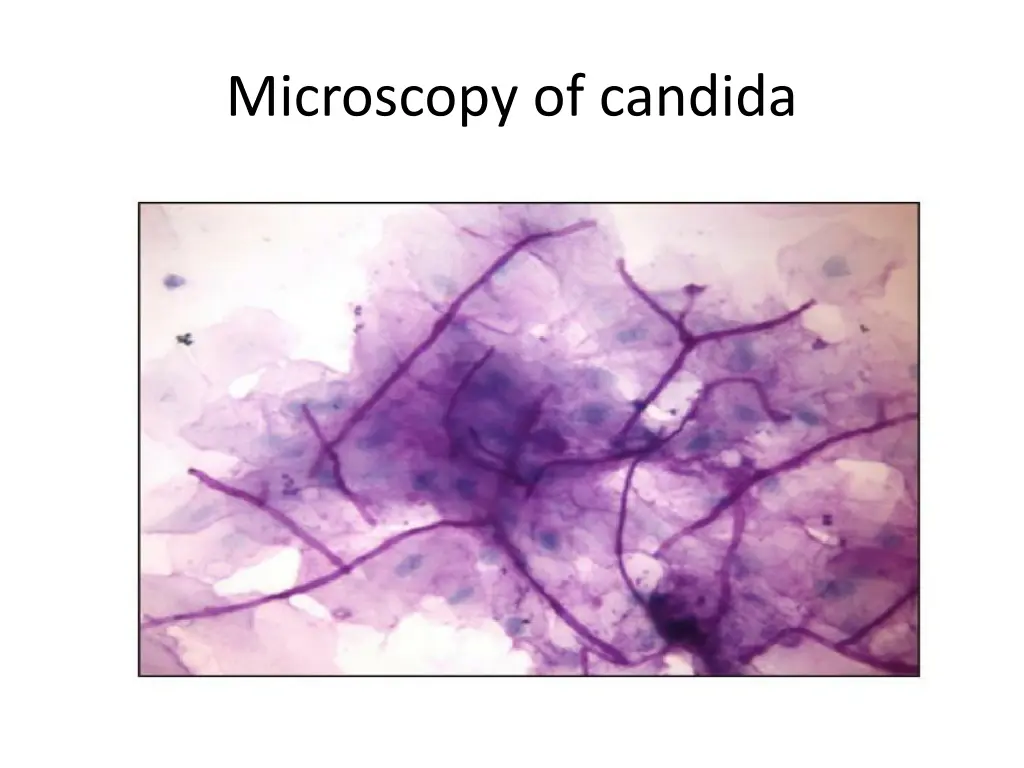 microscopy of candida