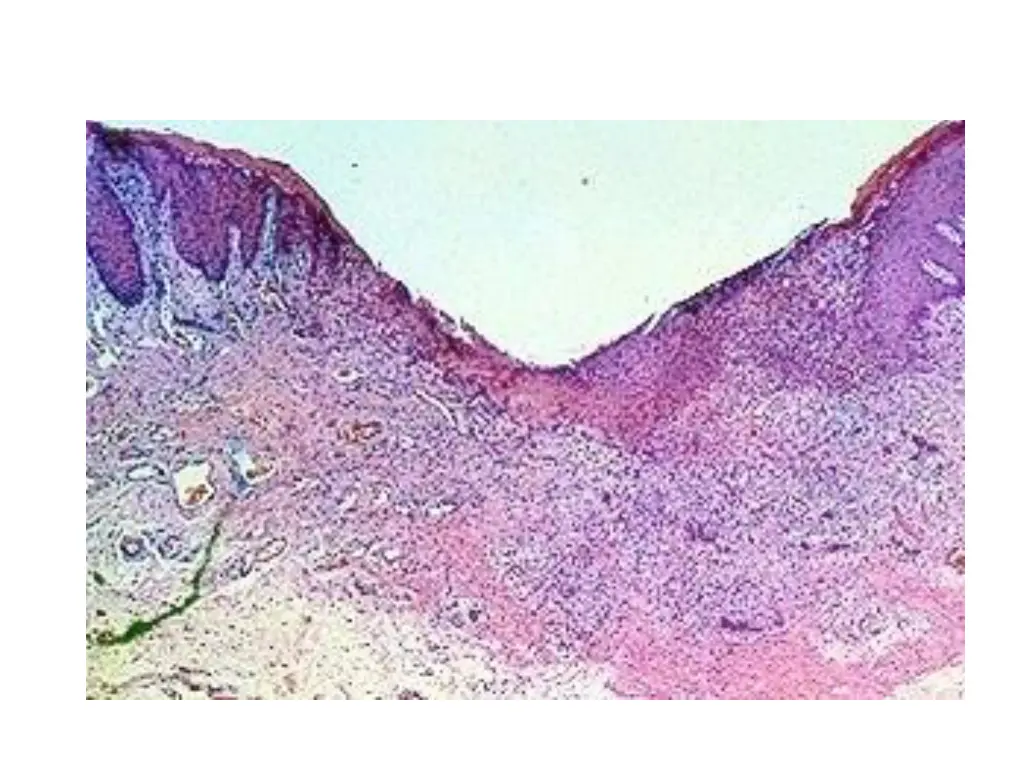 slide8