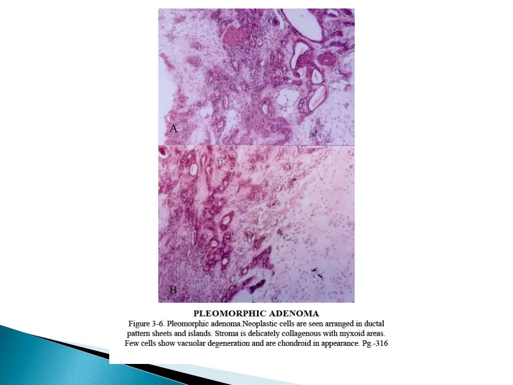 slide18