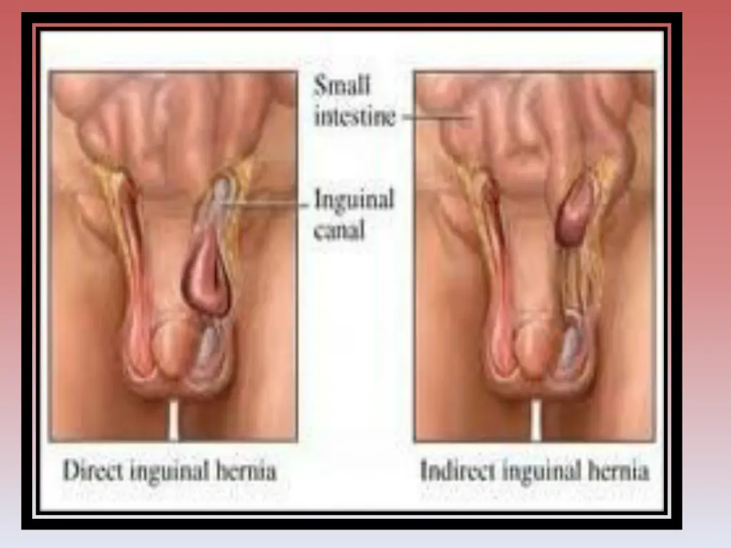 slide11