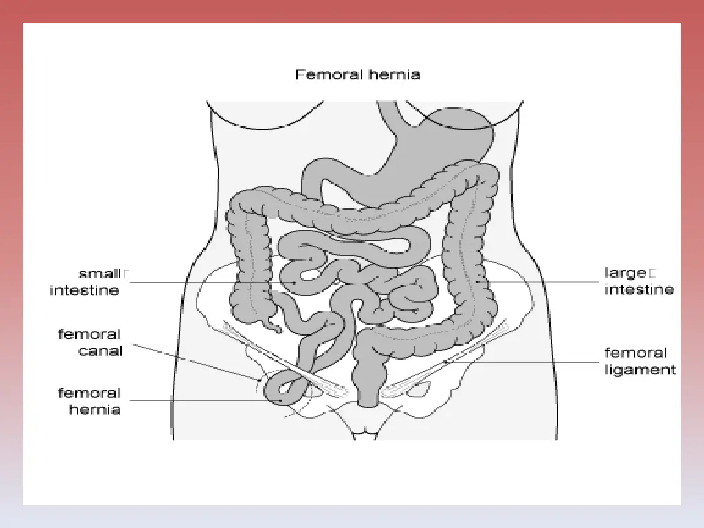 slide14