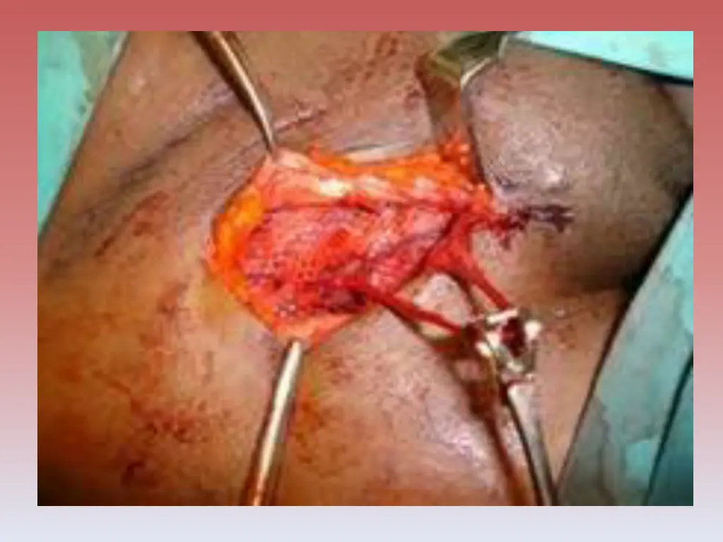 slide27