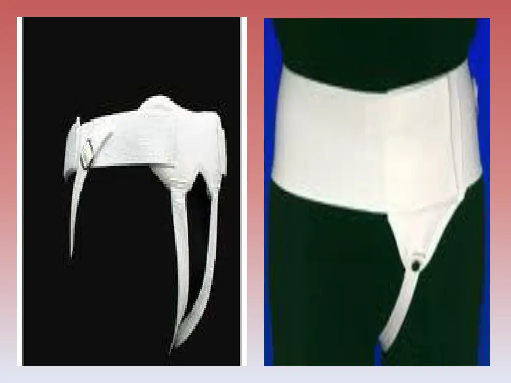 slide32