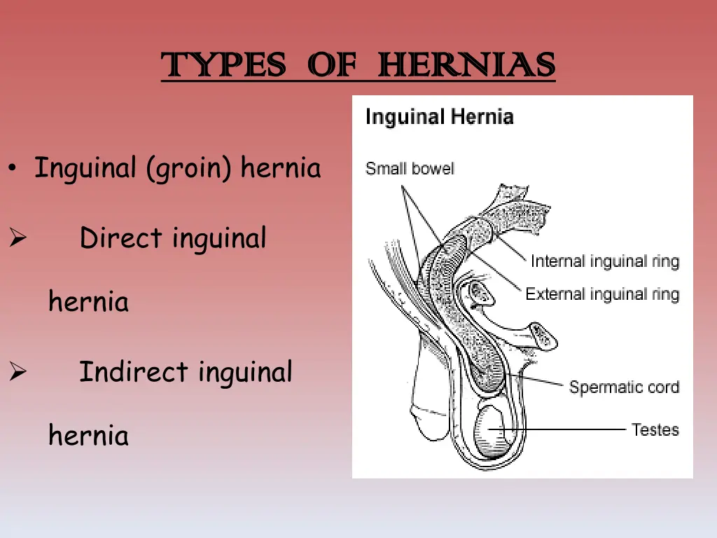 types of hernias types of hernias