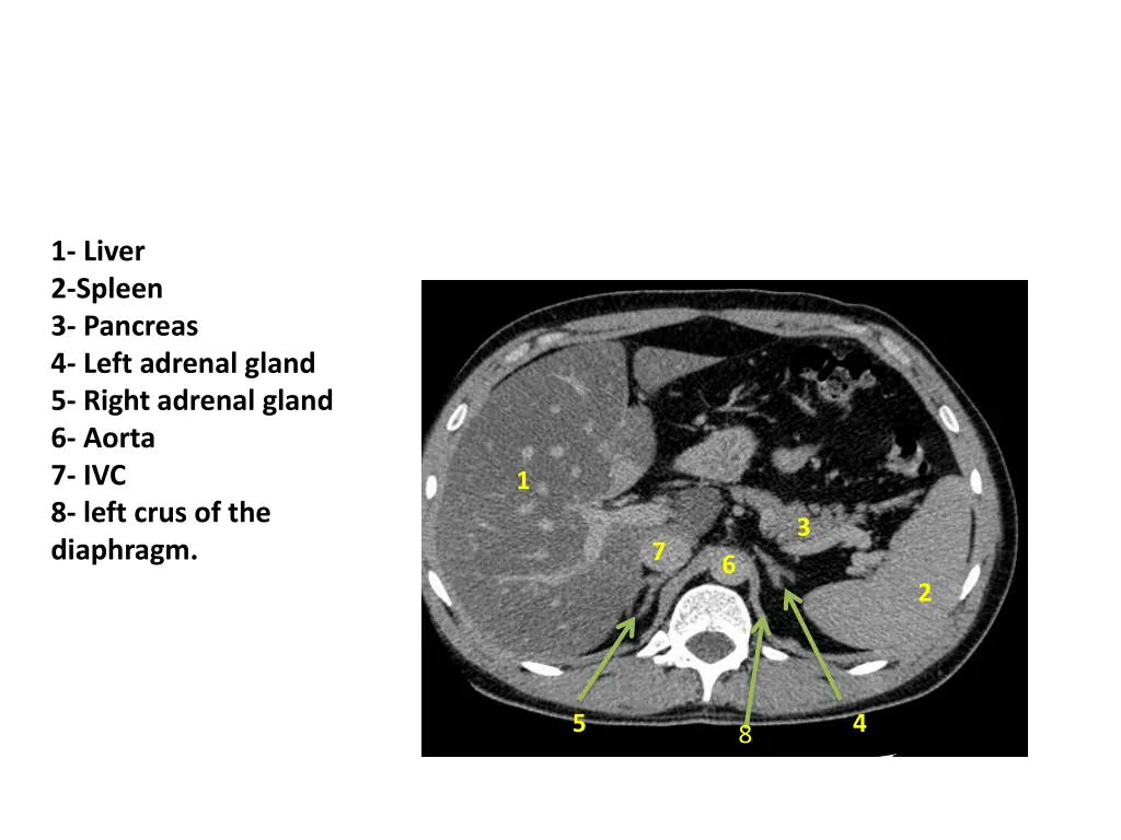 1 liver 2 spleen 3 pancreas 4 left adrenal gland