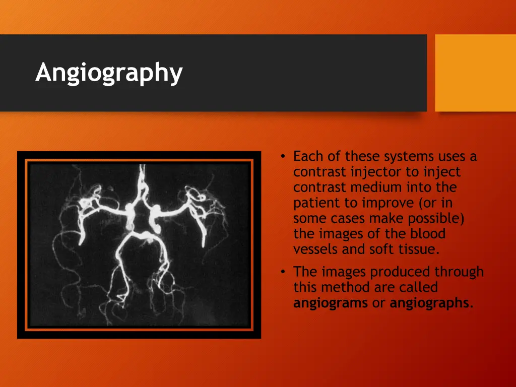 angiography 2