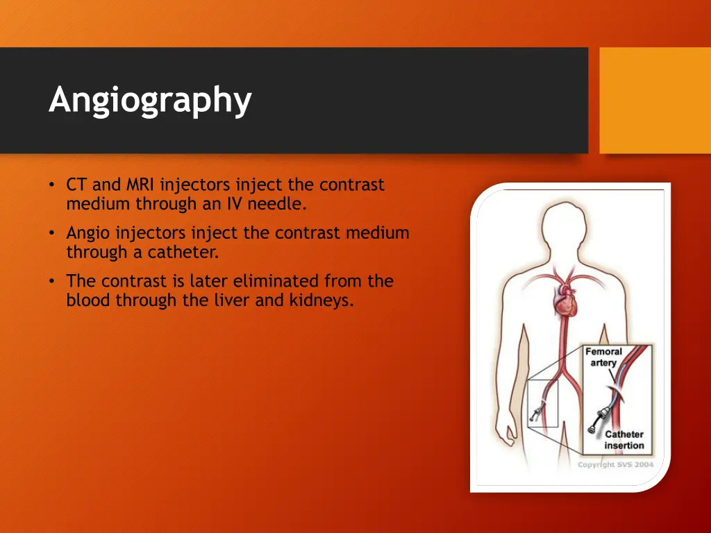 angiography 3