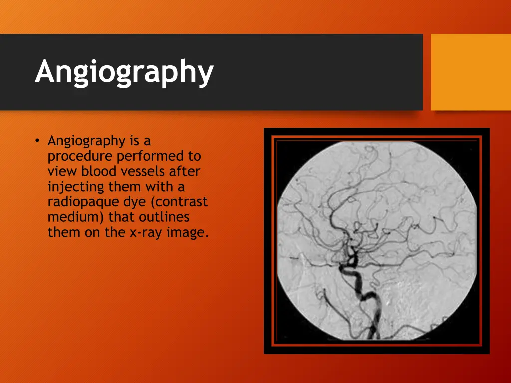 angiography