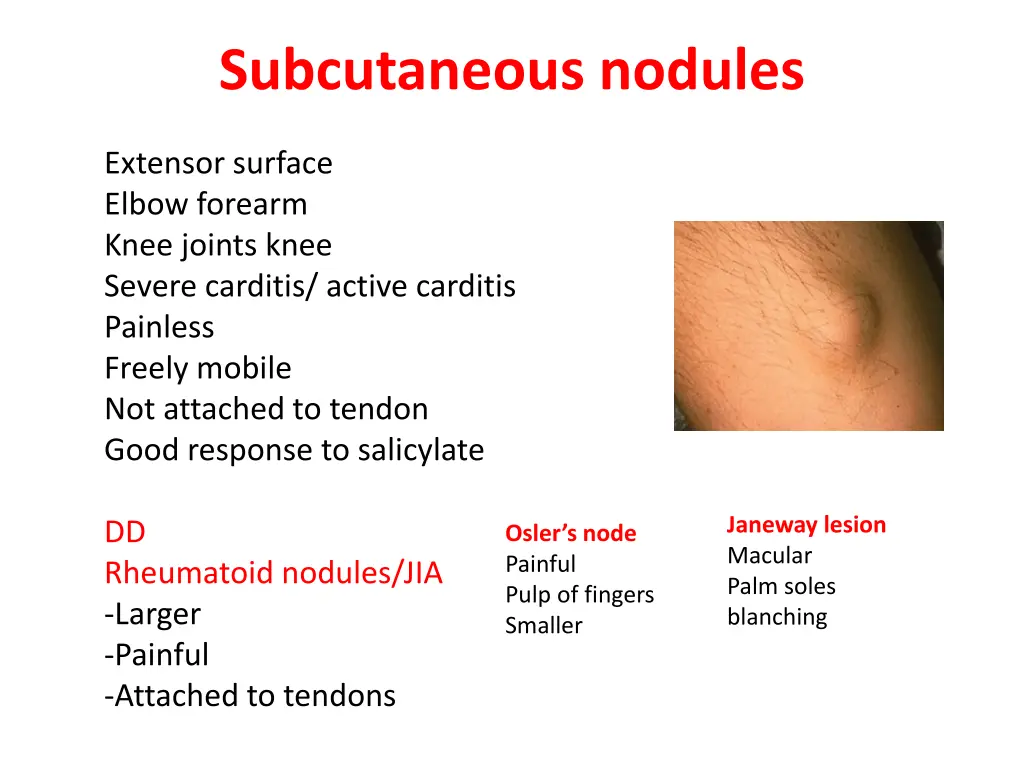 subcutaneous nodules