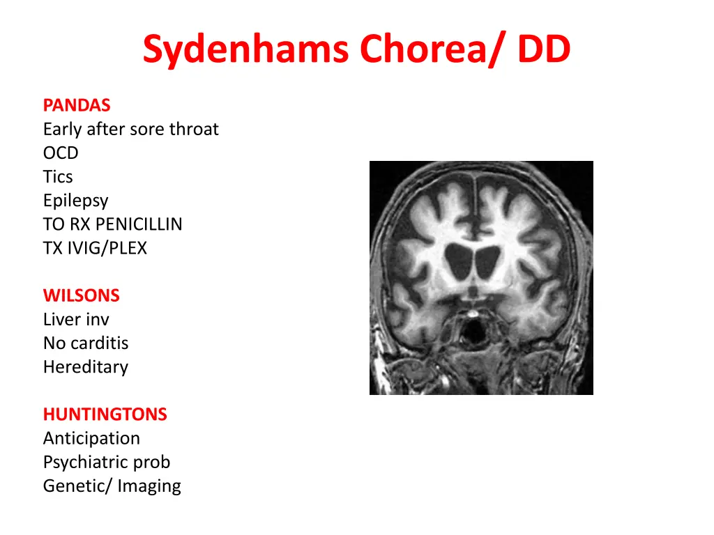 sydenhams chorea dd