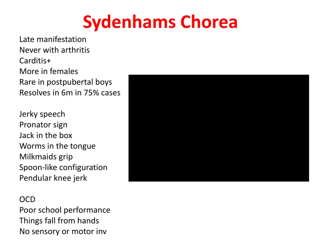 sydenhams chorea late manifestation never with