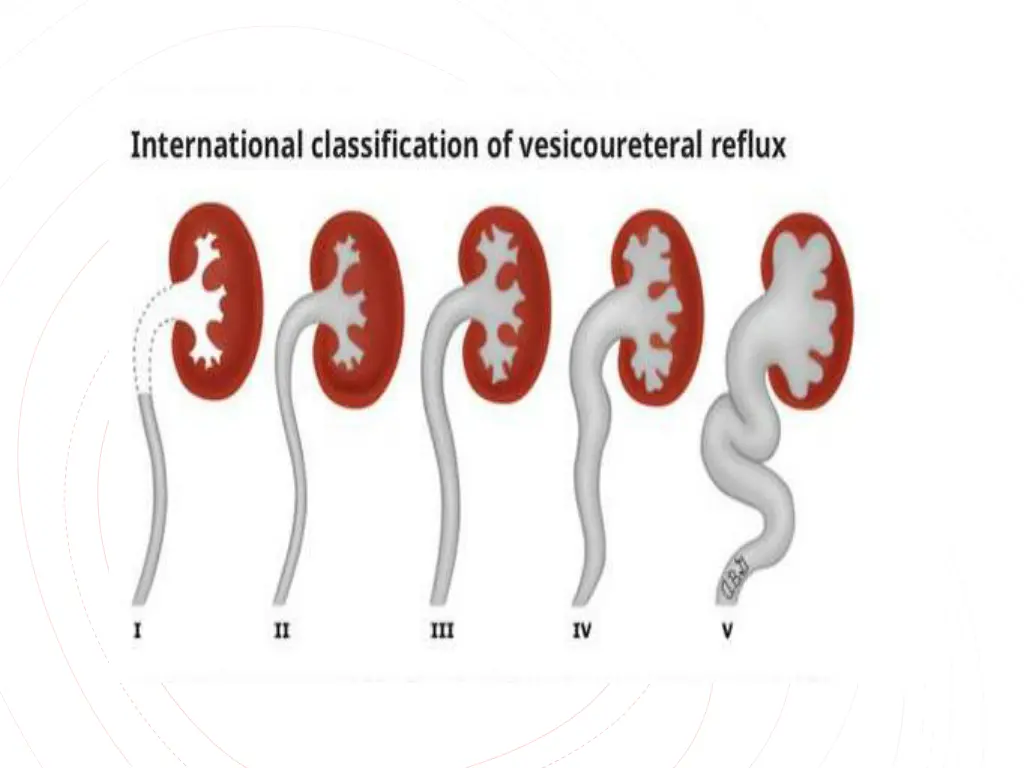 slide15