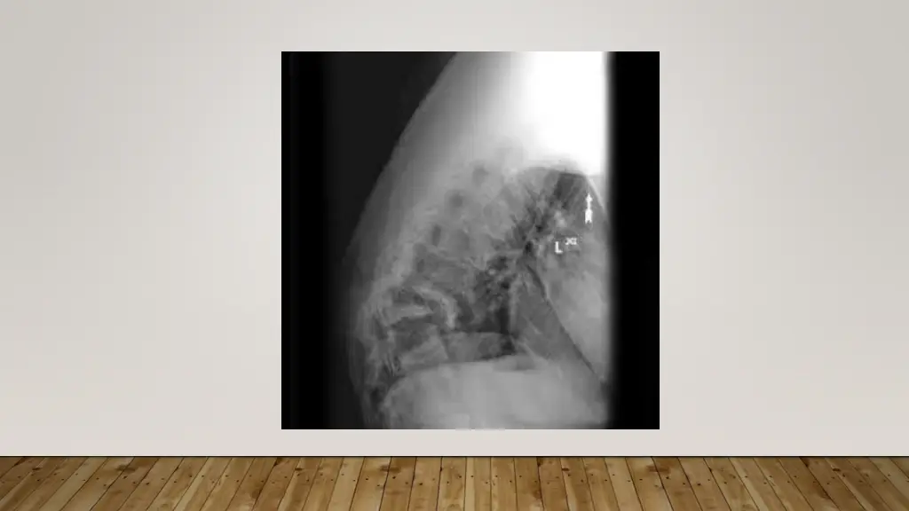 slide11