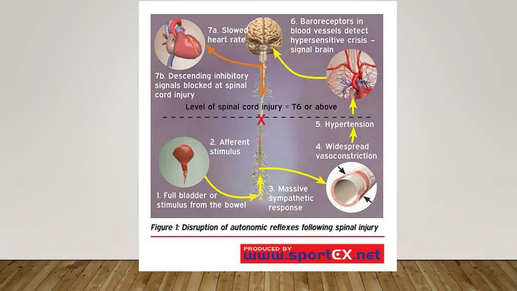slide4