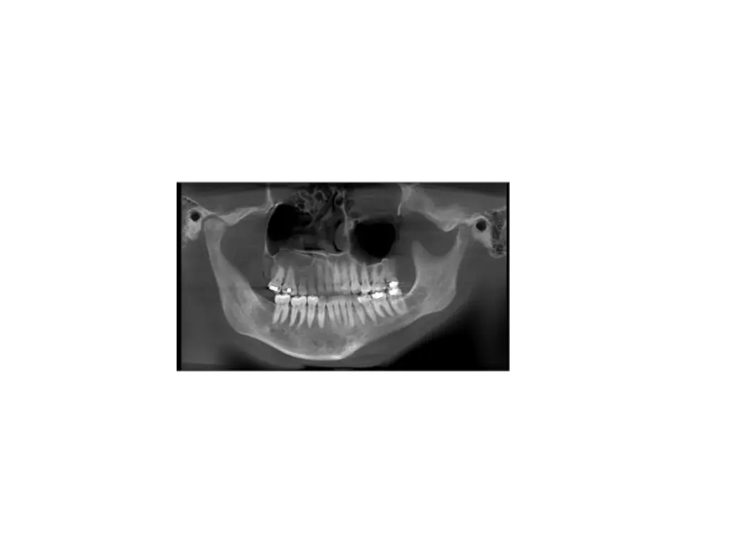 slide37