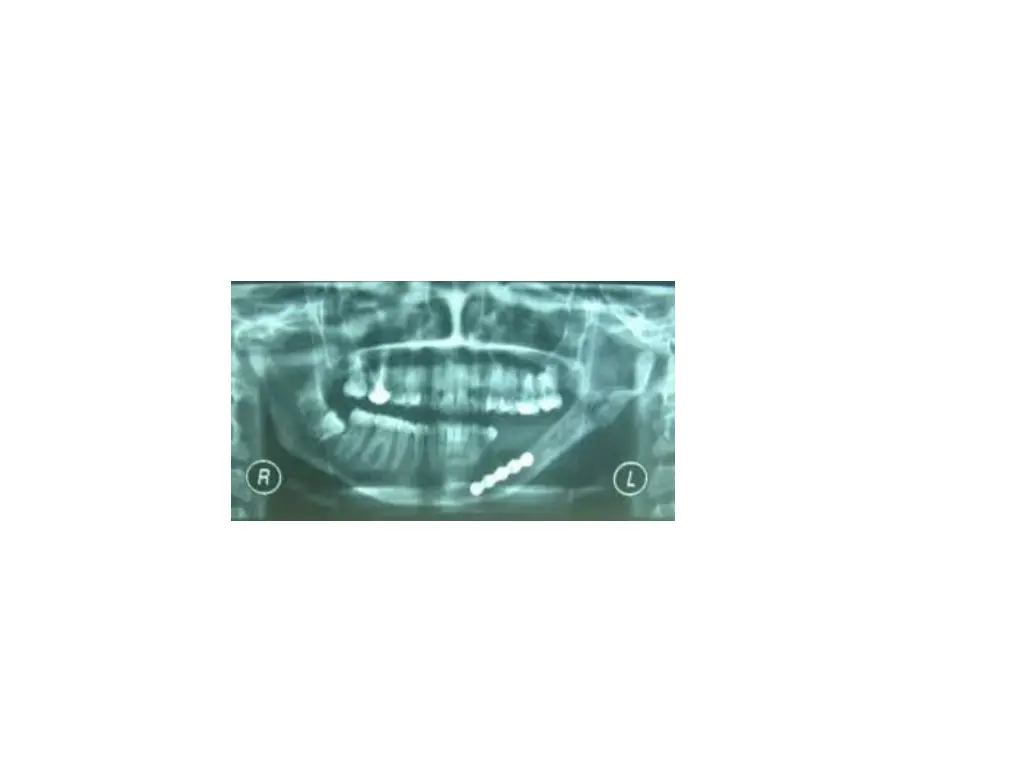 slide46