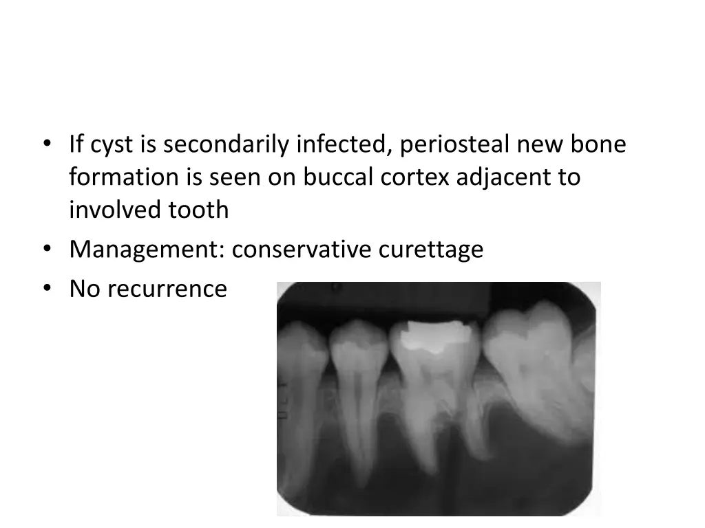 if cyst is secondarily infected periosteal