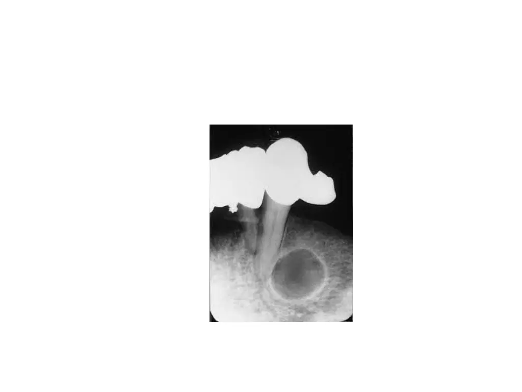 slide14