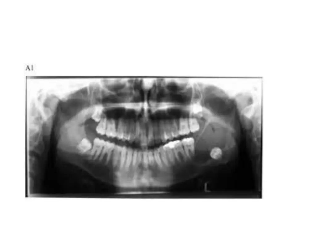 slide18