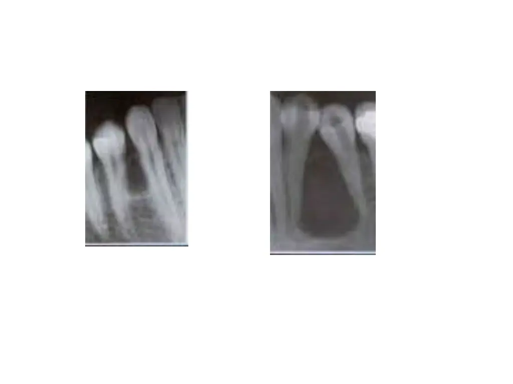 slide33